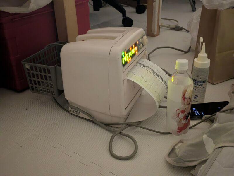 胎児モニター
